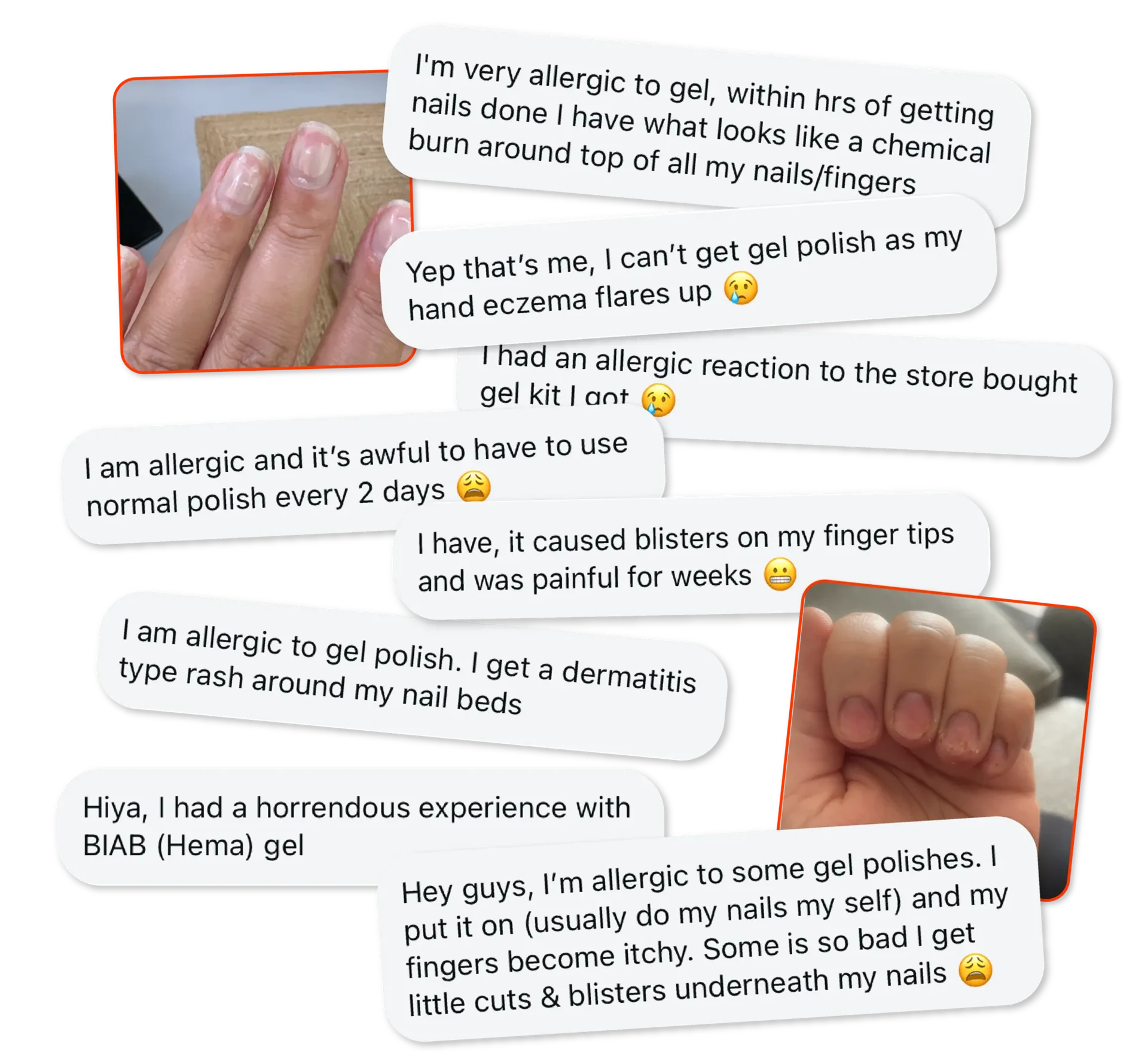 Stories from former gel polish users who have experienced allergic reactions
